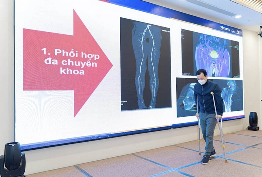 VN ứng dụng công nghệ in 3D trong phẫu thuật điều trị ung thư xương